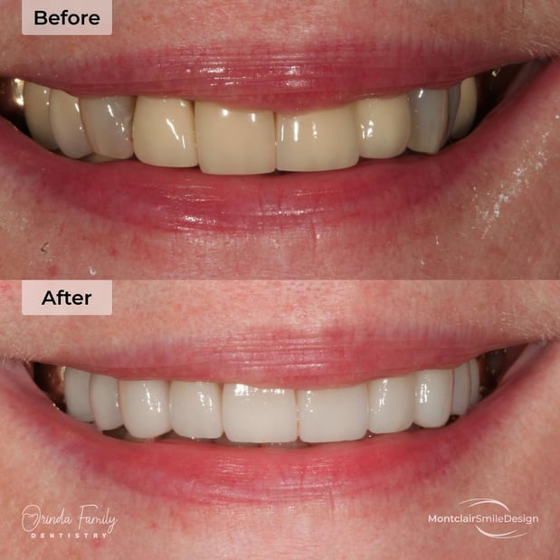 Images Orinda Family Dentistry