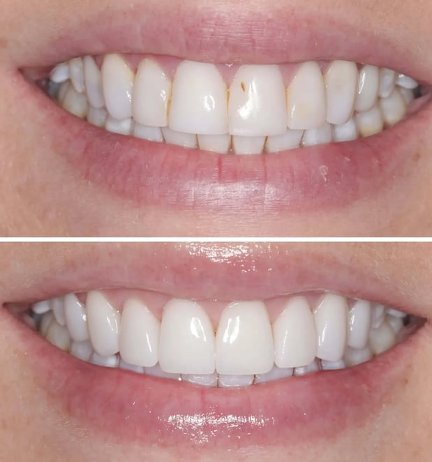 Images Mary Elizabeth Viechnicki, DMD