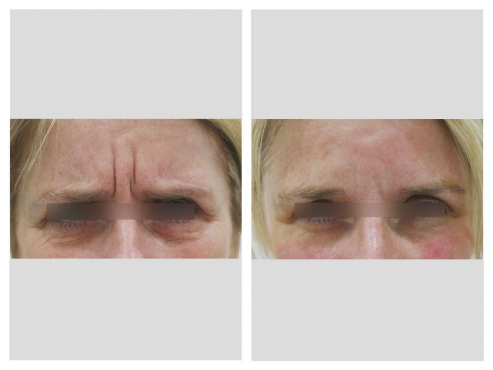 Images About Face Medical Aesthetics - Richmond