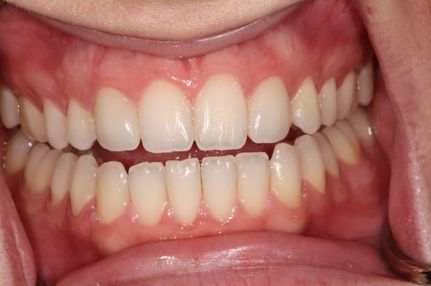 Images North Salem Dental Care