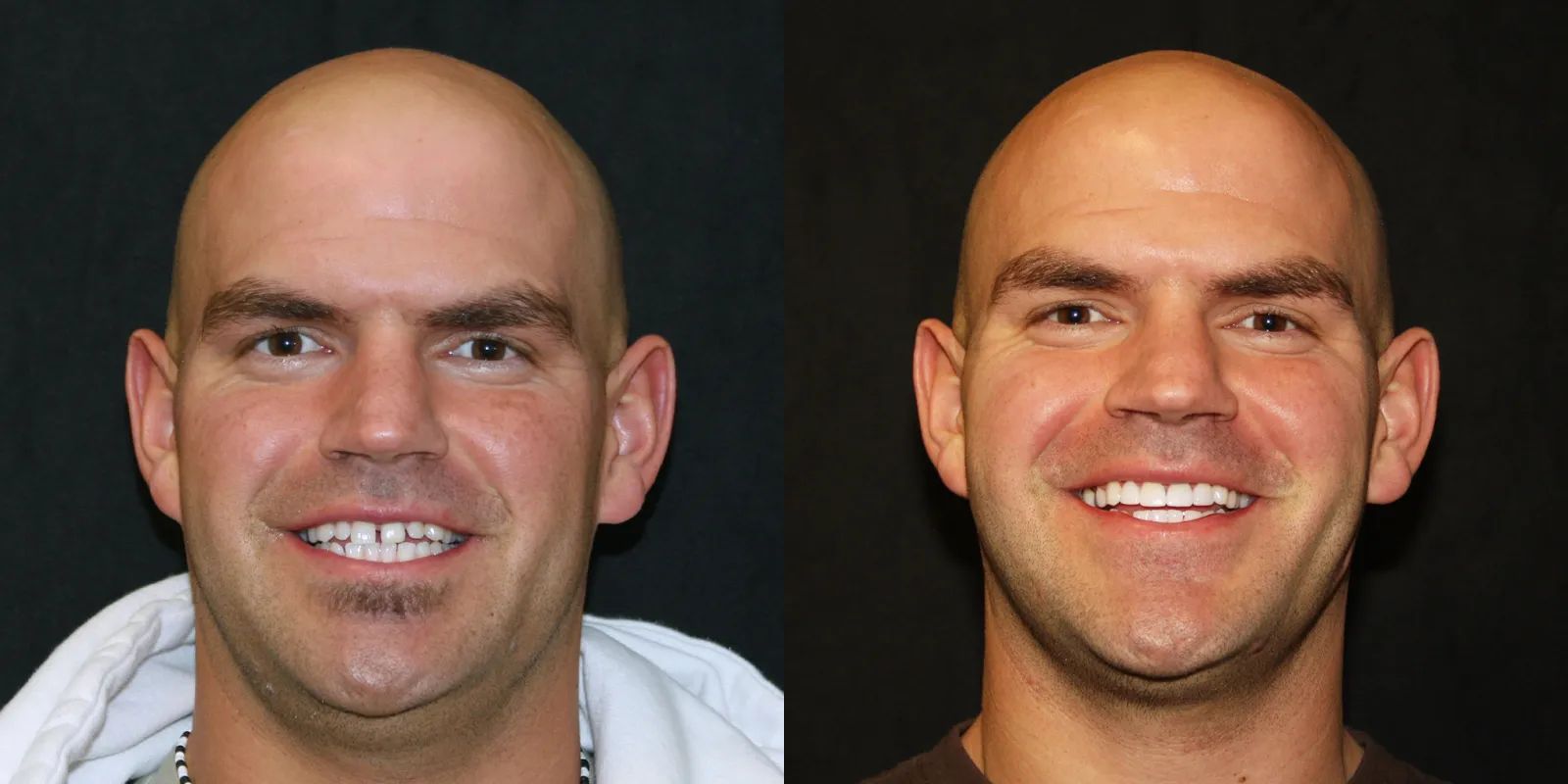 Intermountain Smiles Image