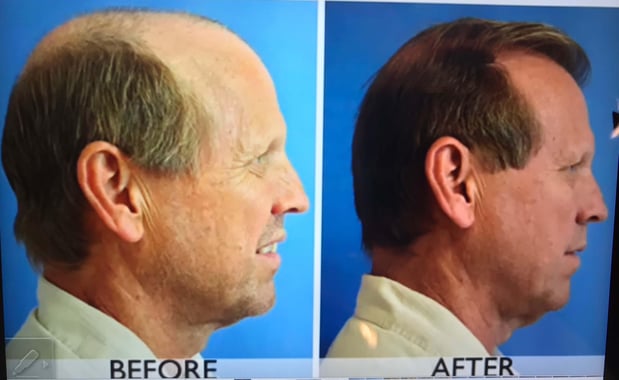 Images Dr. George Brennan - Cosmetic Surgeon Newport Beach