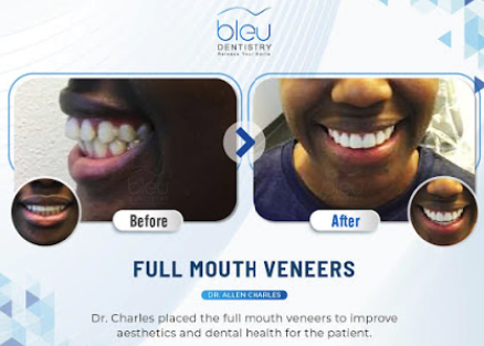 Images Bleu Dentistry
