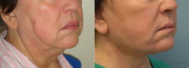Images Providence Facial Plastic and Cosmetic Surgery