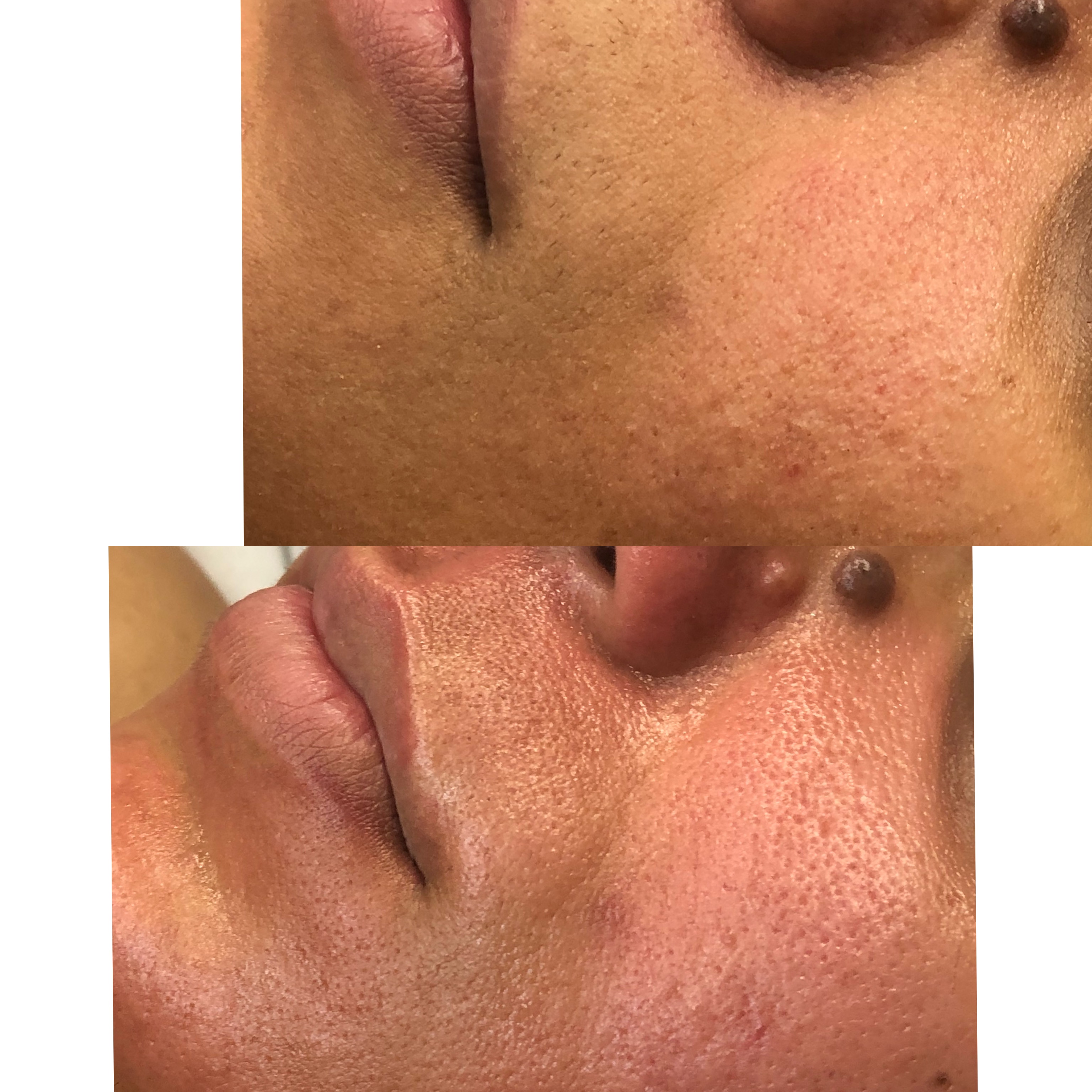 Images Clinique d'Esthétique Leila - Hydrafacial, Microblading, Épilation Laser Sainte-Foy