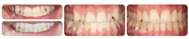 Images Aspire Dental Care PLLC