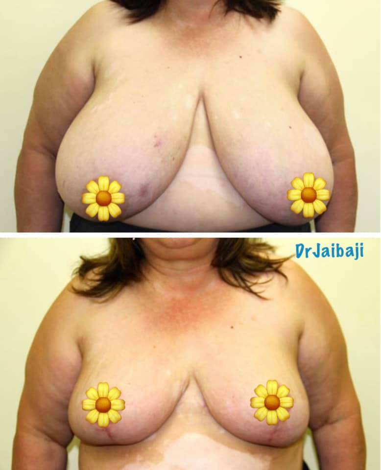 Jaibaji Plastic Surgery Photo