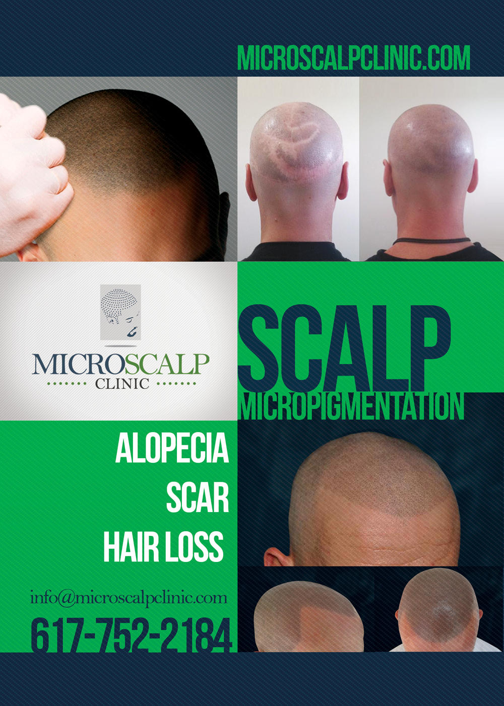 Micro Scalp Clinic http://www.microscalpclinic.com/