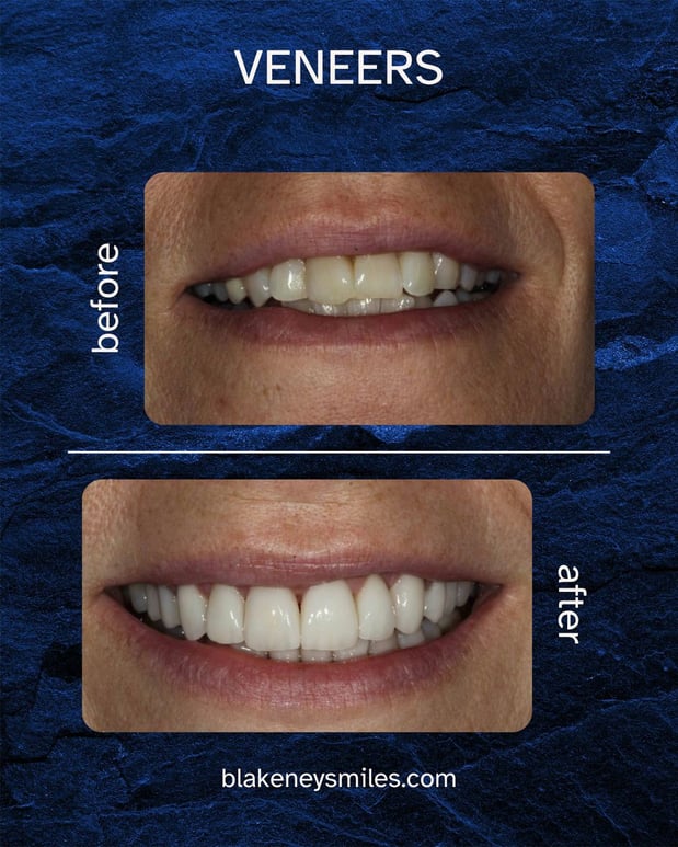 Images Advanced Dentistry of Blakeney