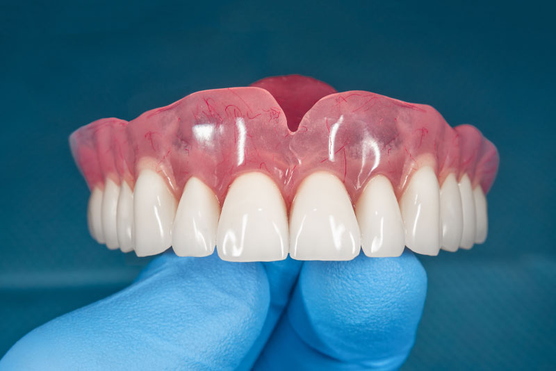Images Best Value Dentures and Implants Palmetto Bay