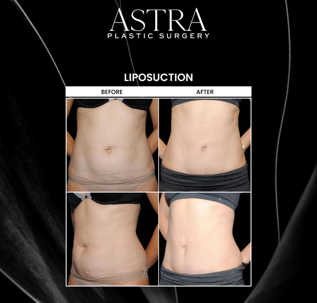 Images Astra Plastic Surgery - Marietta