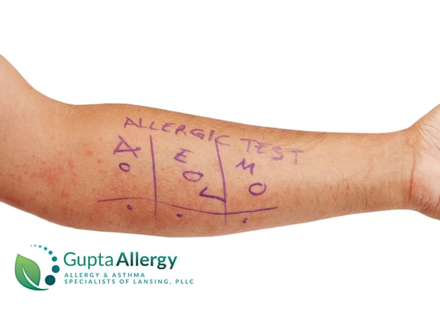 Images Gupta Allergy: Allergy & Asthma Specialists of Lansing, PLLC