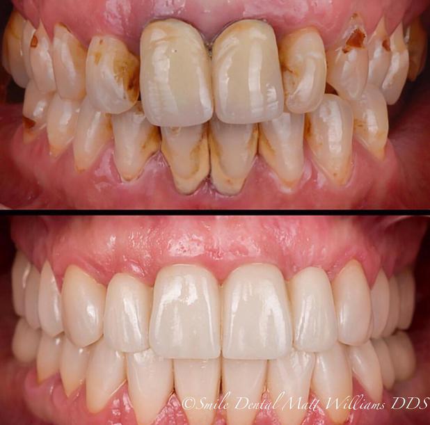Images Smile Dental