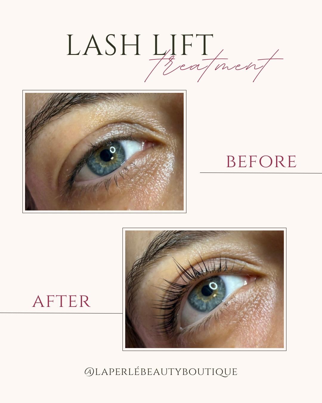 Bild 8 La Perlé Beauty Boutique | Kosmetik & Laserhaarentfernung in Frankfurt am Main