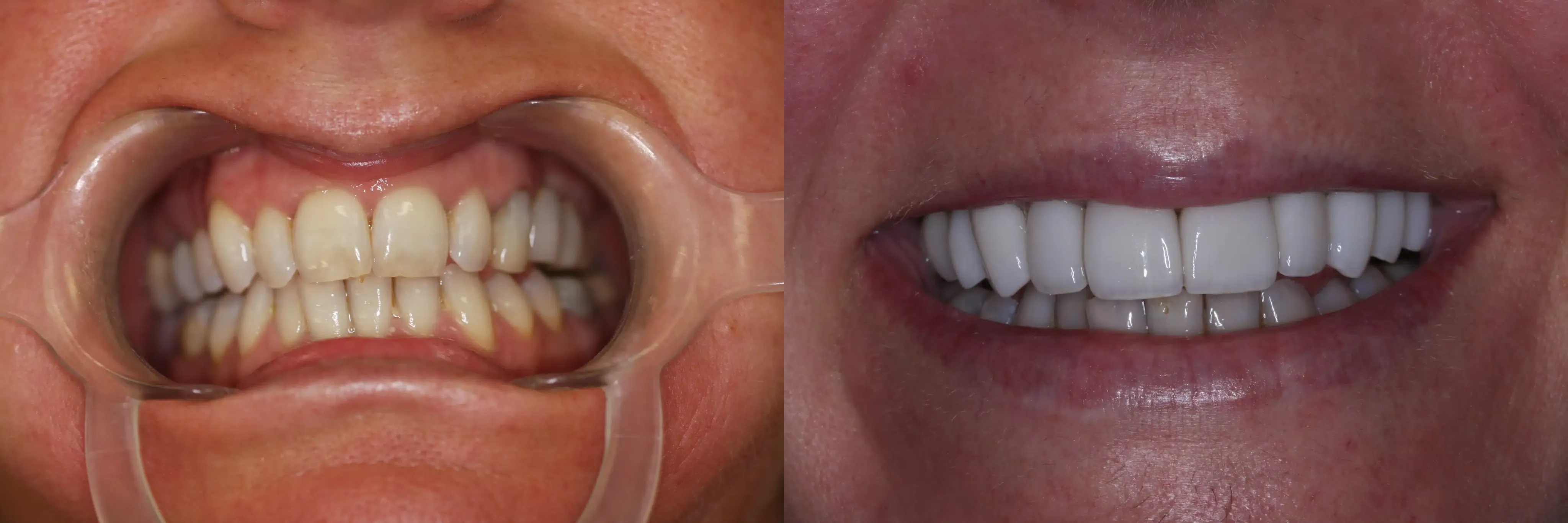 Dental Care of Jackson Hole Image