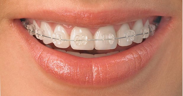 Images Salaita Orthodontics