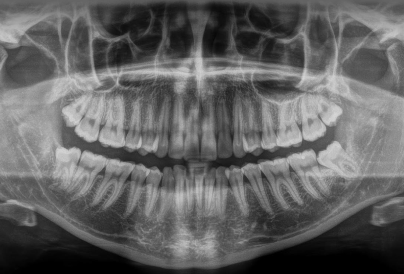 Images Studio Radiologico Busoni -  Dentalscan Ecografie Rx