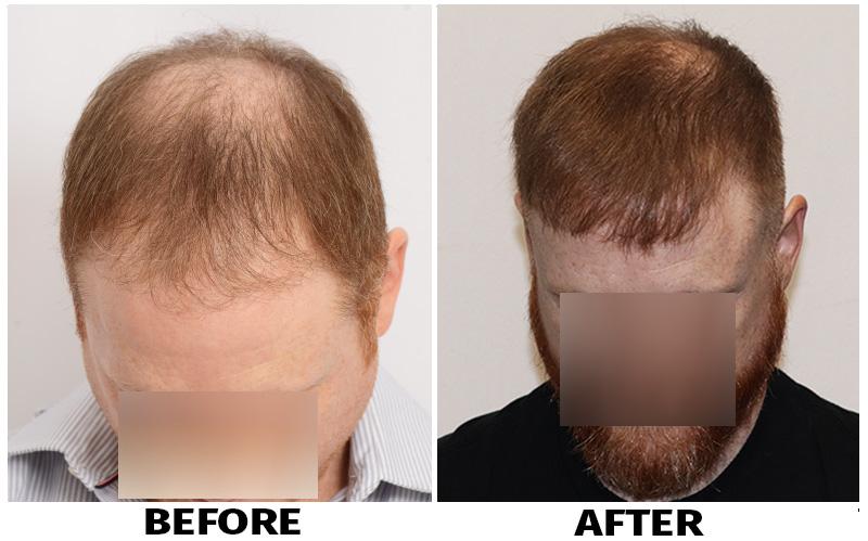 Images ForHair NYC Restoration Clinic - Dr. John Cole