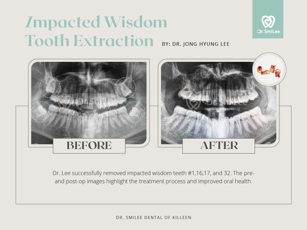 Images Dr Smilee Dental of Killeen, Family, Cosmetic, Implant, Medspa
