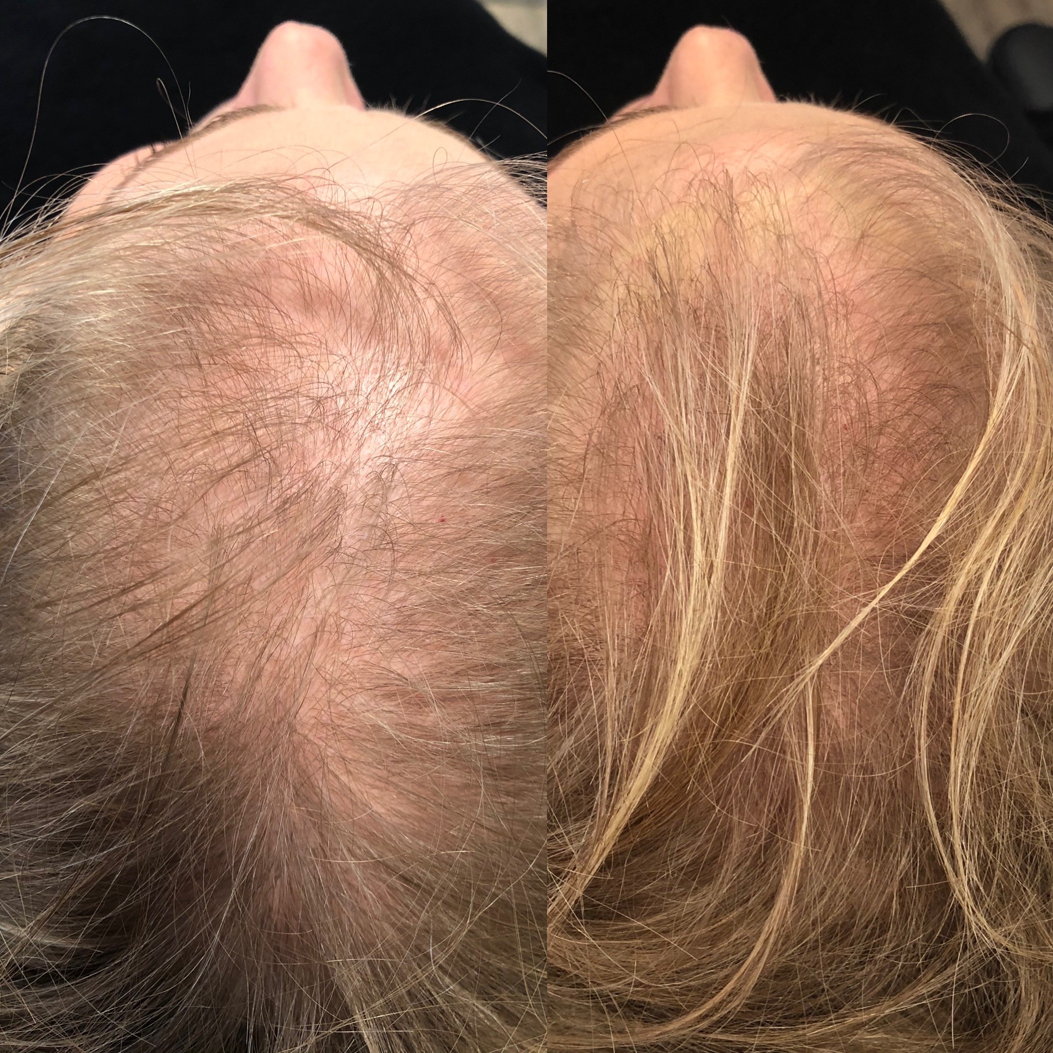 REMEDY Hair Restoration & Medical Spa Photo