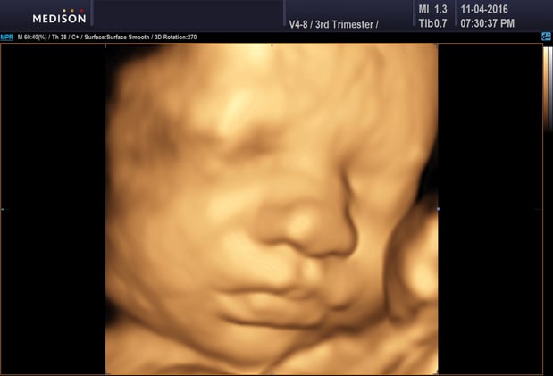 Images Heavenly 3D 4D Ultrasounds