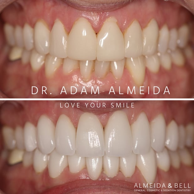 Images Almeida & Bell Dental Lone Tree - General, Cosmetic, and Implant Dentistry
