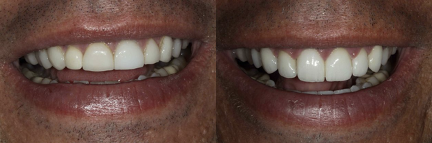 Images Advanced Dentistry of Blakeney