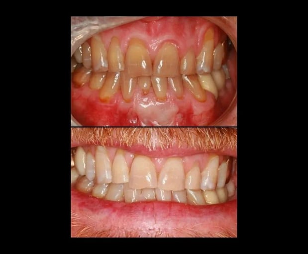 Images Legacy Dental Arts