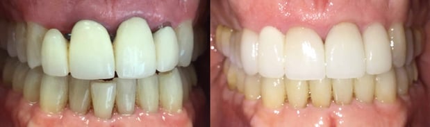 Images Premier Dental of South Orange County