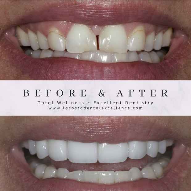 Images Oceanside Dental Excellence