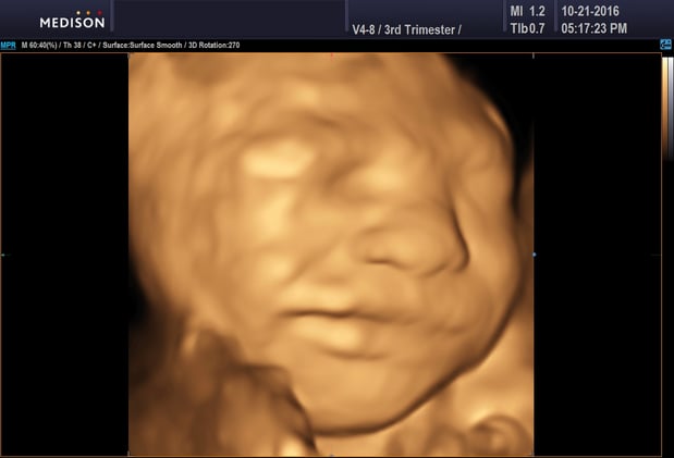 Images Heavenly 3D 4D Ultrasounds