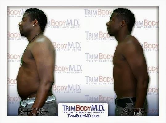 Images TrimBody M.D.