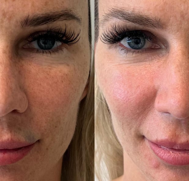 Images Infinity Beauty Lab Med Spa
