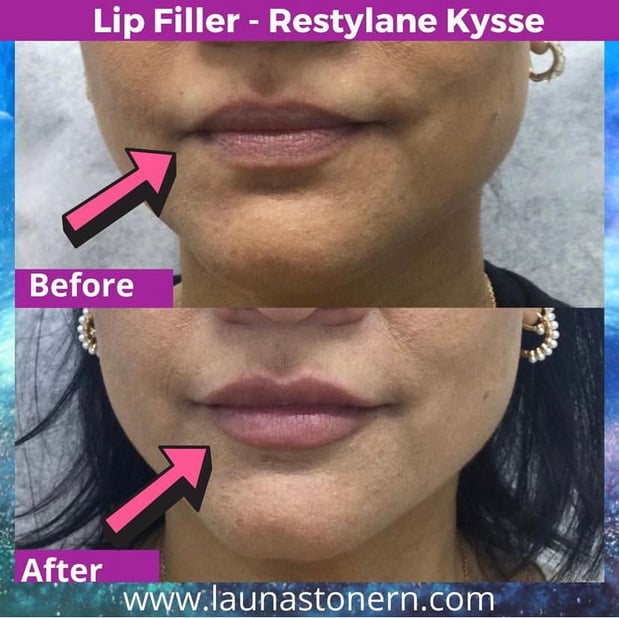 Images Launa Stone, R.N.