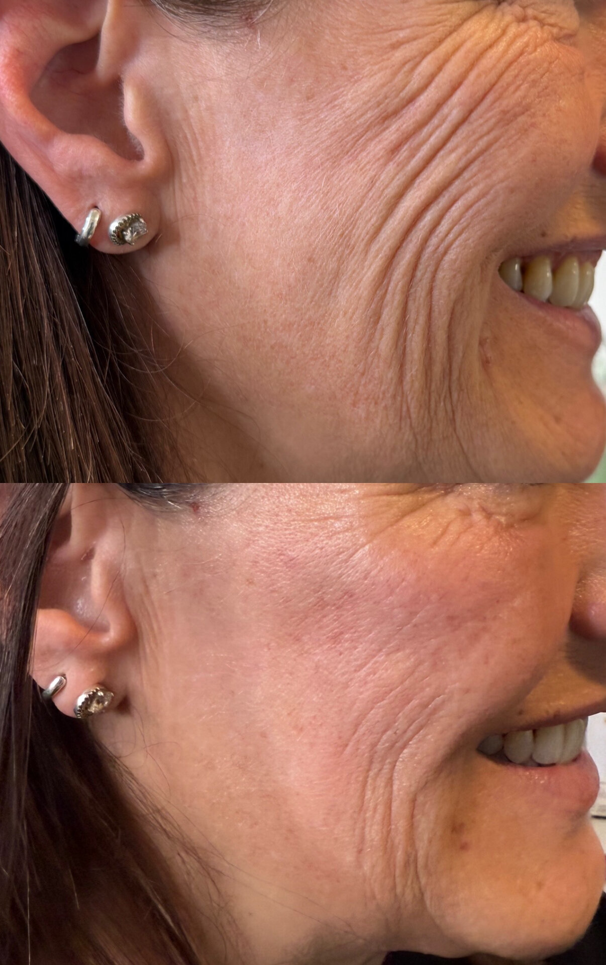 Images Harvey Medical Aesthetics