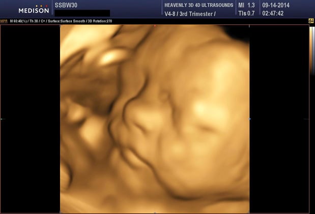 Images Heavenly 3D 4D Ultrasounds-Upland