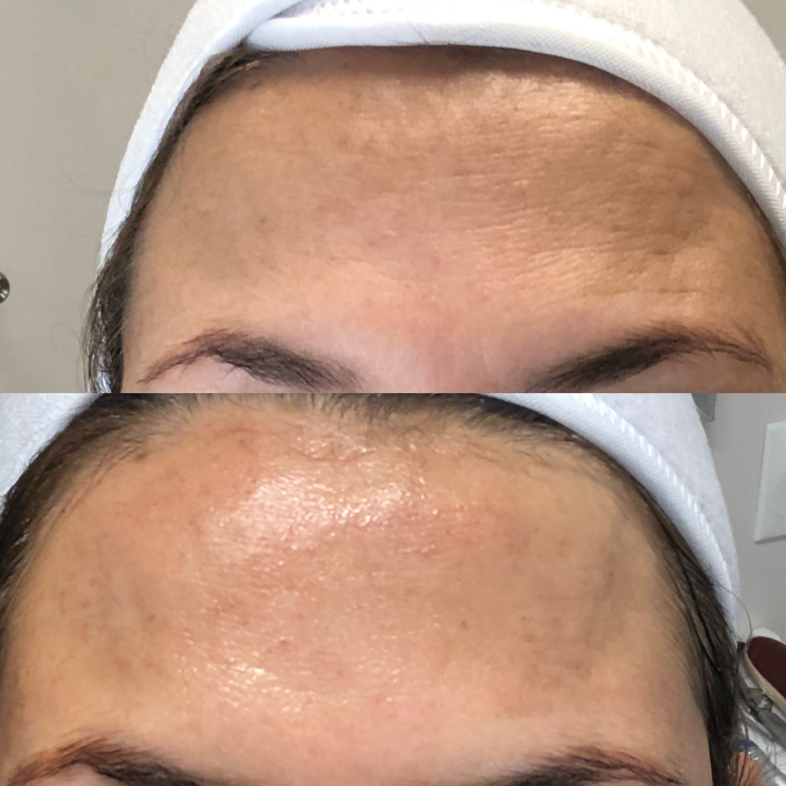 Images Clinique d'Esthétique Leila - Hydrafacial, Microblading, Épilation Laser Sainte-Foy