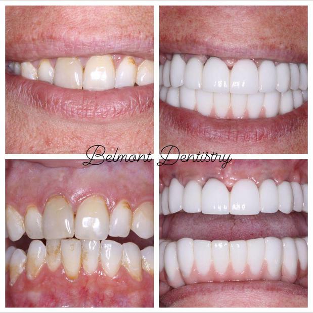 Images Belmont Dentistry Peoria