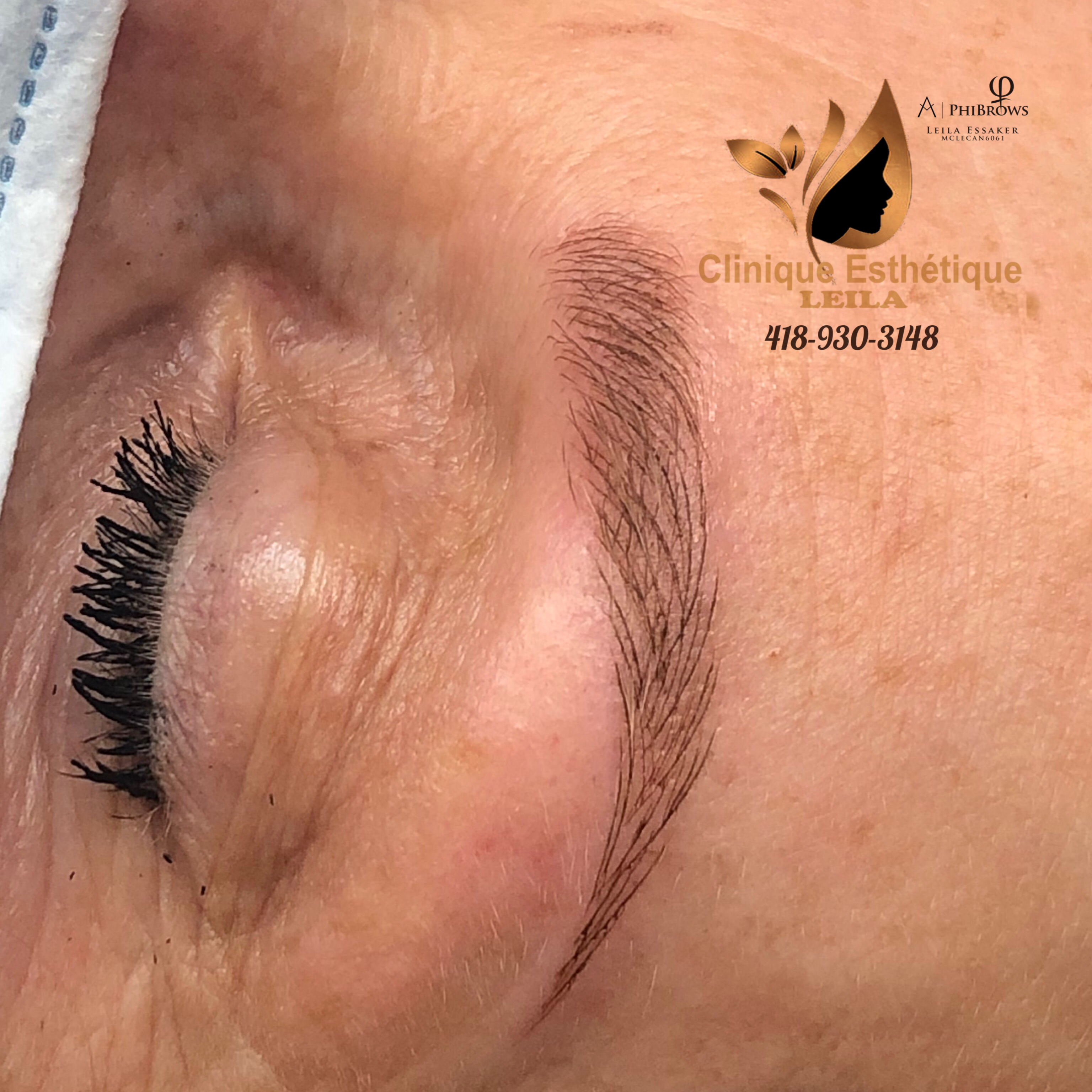 Images Clinique d'Esthétique Leila - Hydrafacial, Microblading, Épilation Laser Sainte-Foy
