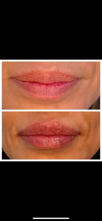 Images Body Lounge Park Cities - Whole Body Wellness & Medical Aesthetics, Dallas, TX