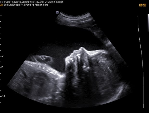 Images Heavenly 3D 4D Ultrasounds-Upland