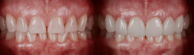 Images Jeppson Dental