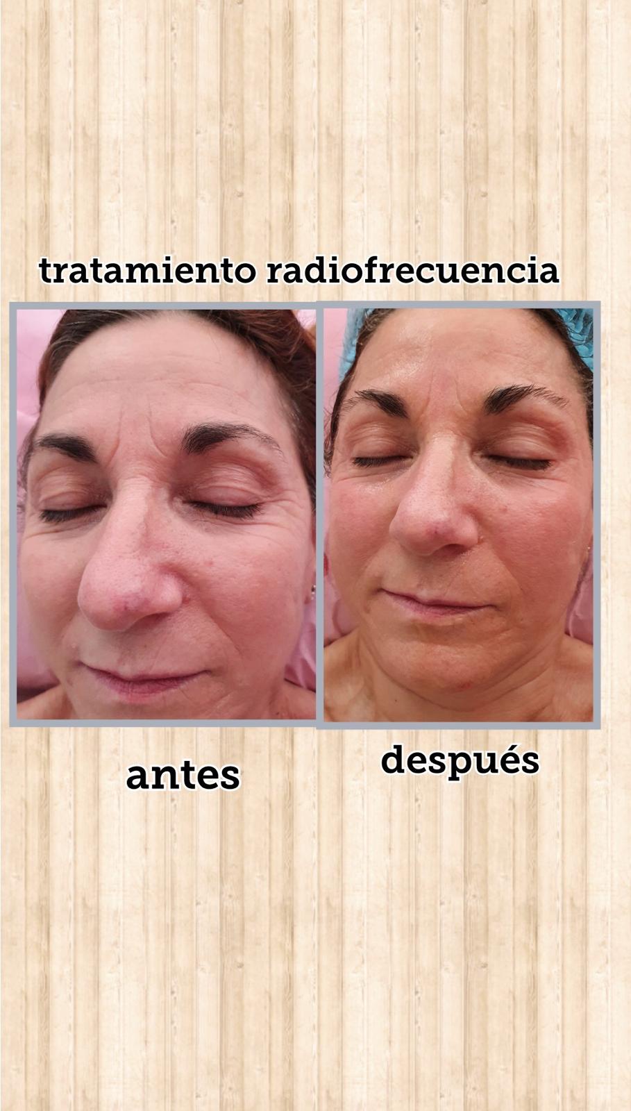 Images Centro De Estética Avanzada Y Láser Verónica Vico