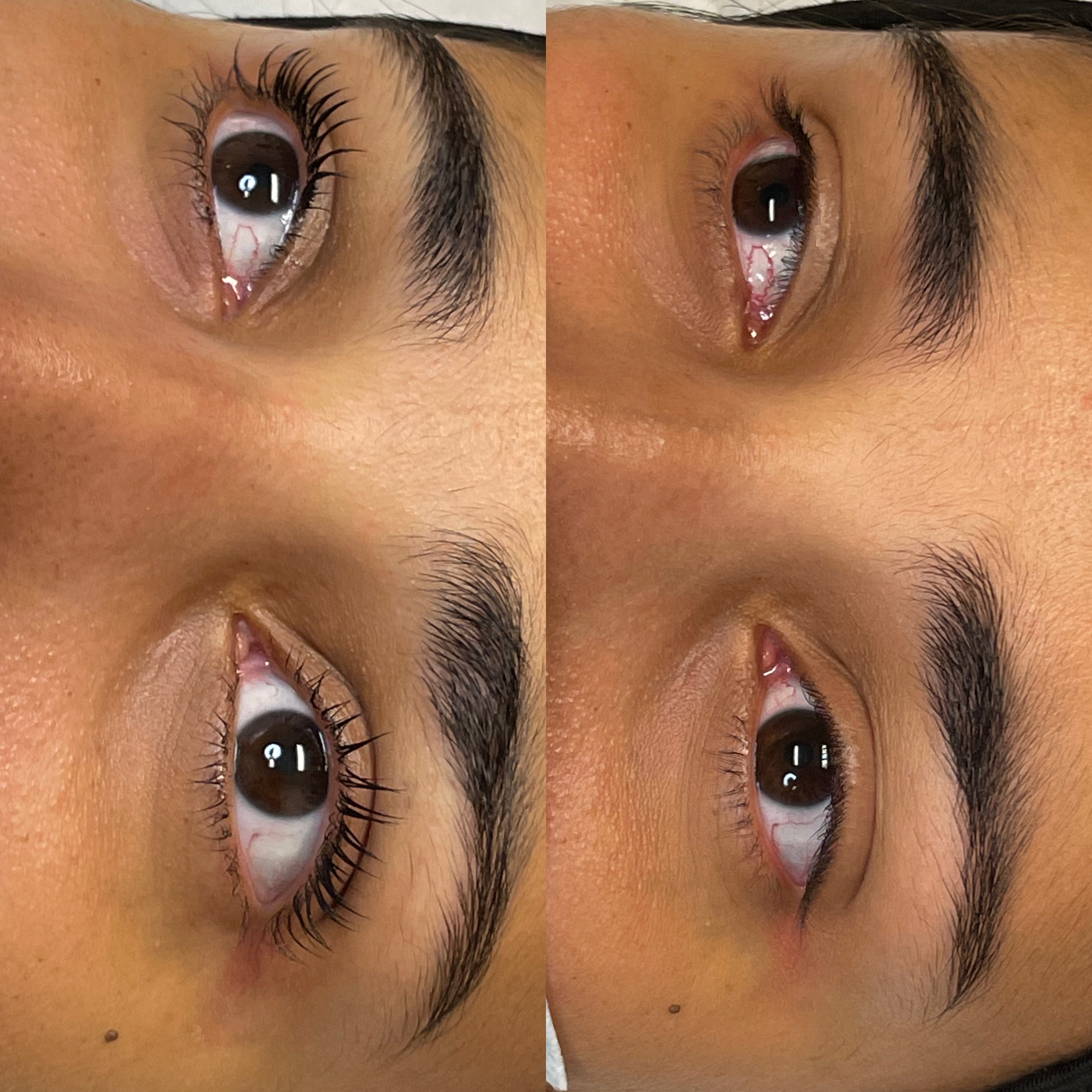 Images Clinique d'Esthétique Leila - Hydrafacial, Microblading, Épilation Laser Sainte-Foy