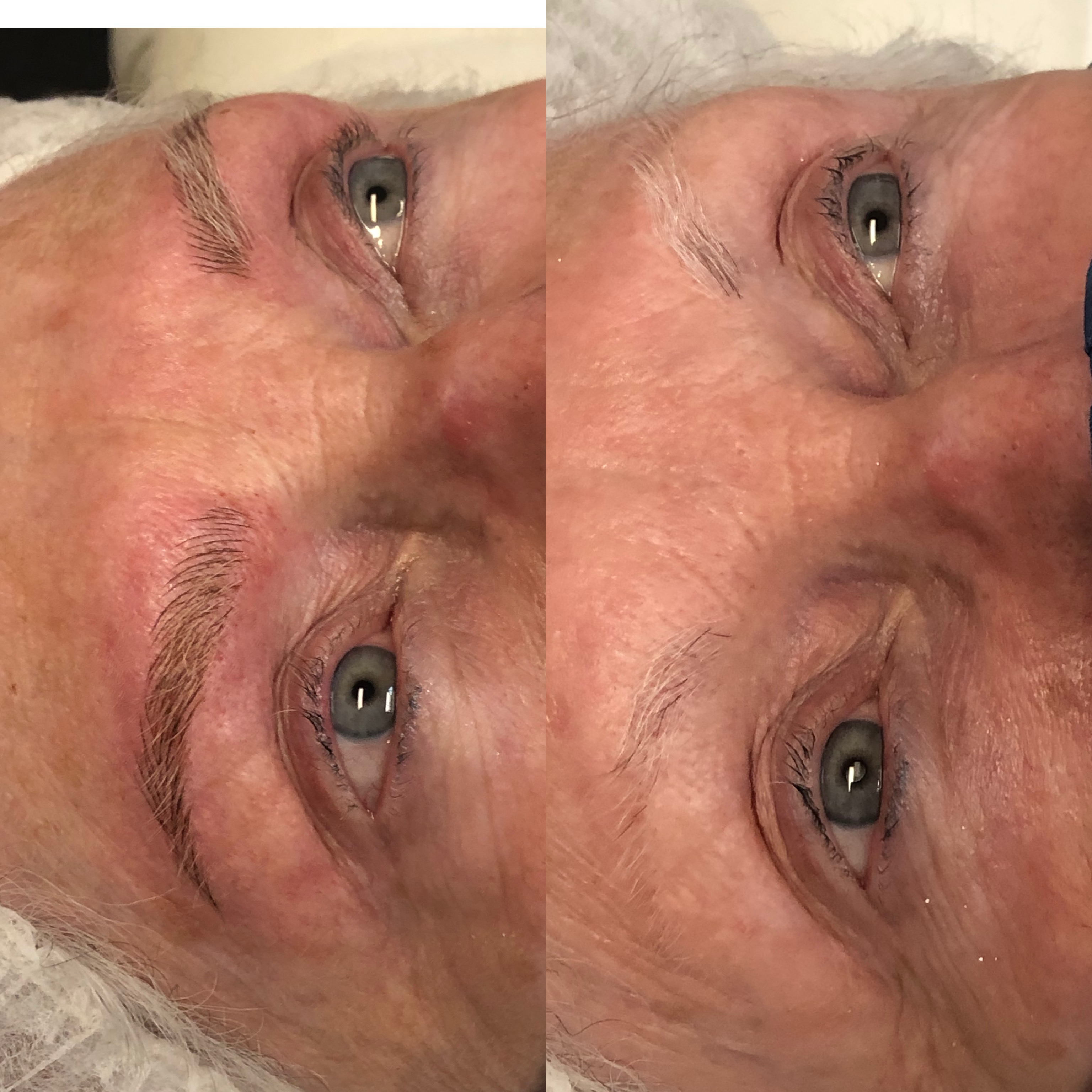 Images Clinique d'Esthétique Leila - Hydrafacial, Microblading, Épilation Laser Sainte-Foy