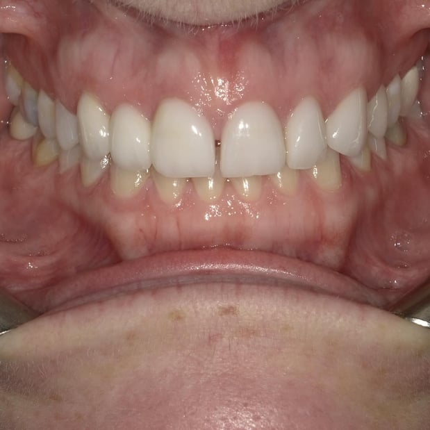 Images Reimels Family & Cosmetic Dentistry