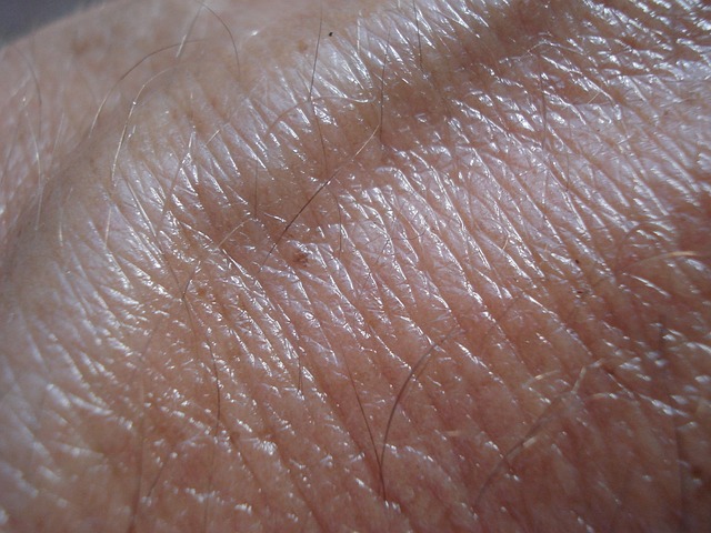 Haut | Hautarztpraxis | Dr. med. Rosita Süß | München