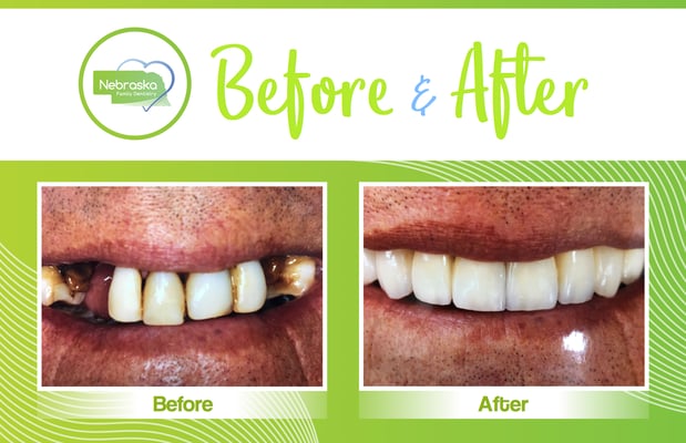 Images Lincoln Family Dentistry