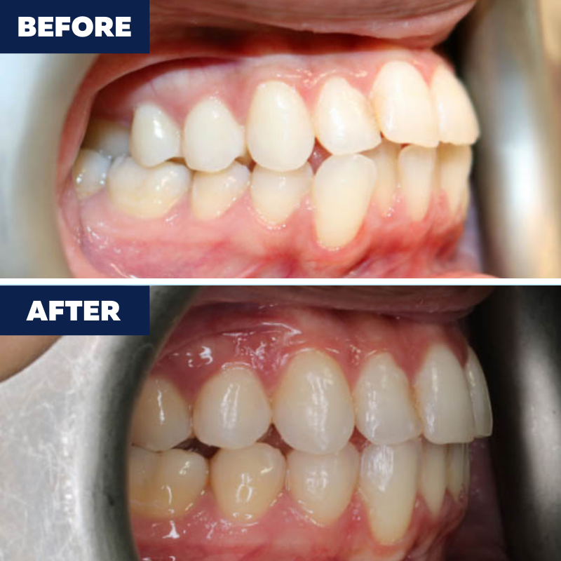 Images Orthodontics of Downey