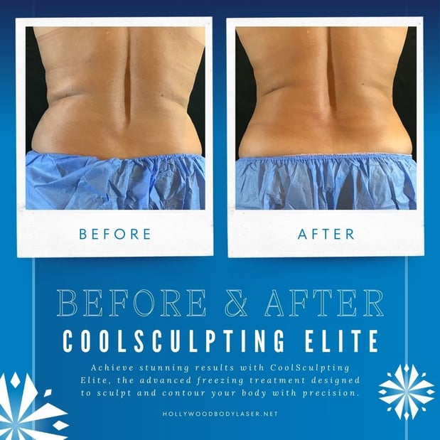 Images Hollywood Body & Face Colorado Springs